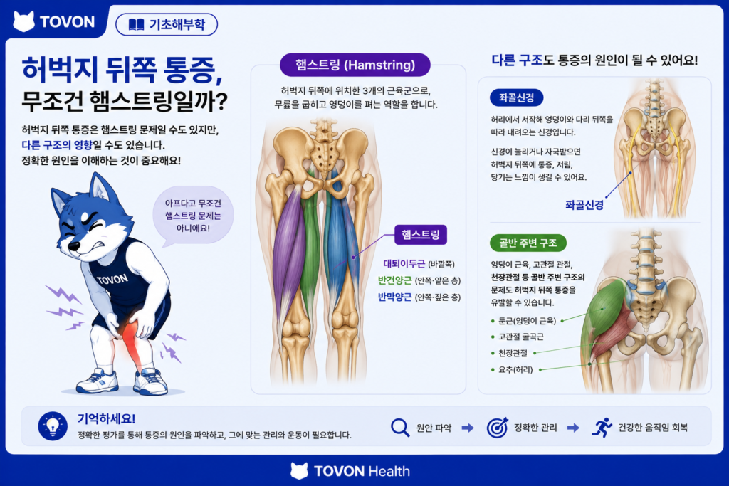 햄스트링이란? 허벅지 뒤쪽 근육의 구조와 역할 허벅지 뒤쪽 통증이 햄스트링 외 다른 구조와도 관련될 수 있음을 보여주는 이미지